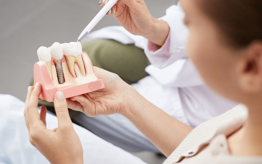 5 consejos post-implante dental